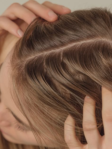 Hairloss