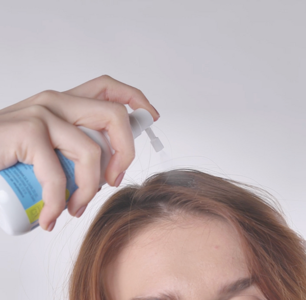 Anti Hair Loss Lotion